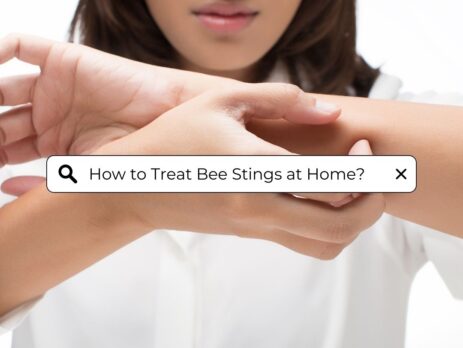 bee-removal-experts-tips-on-how-to-treat-bee-stings